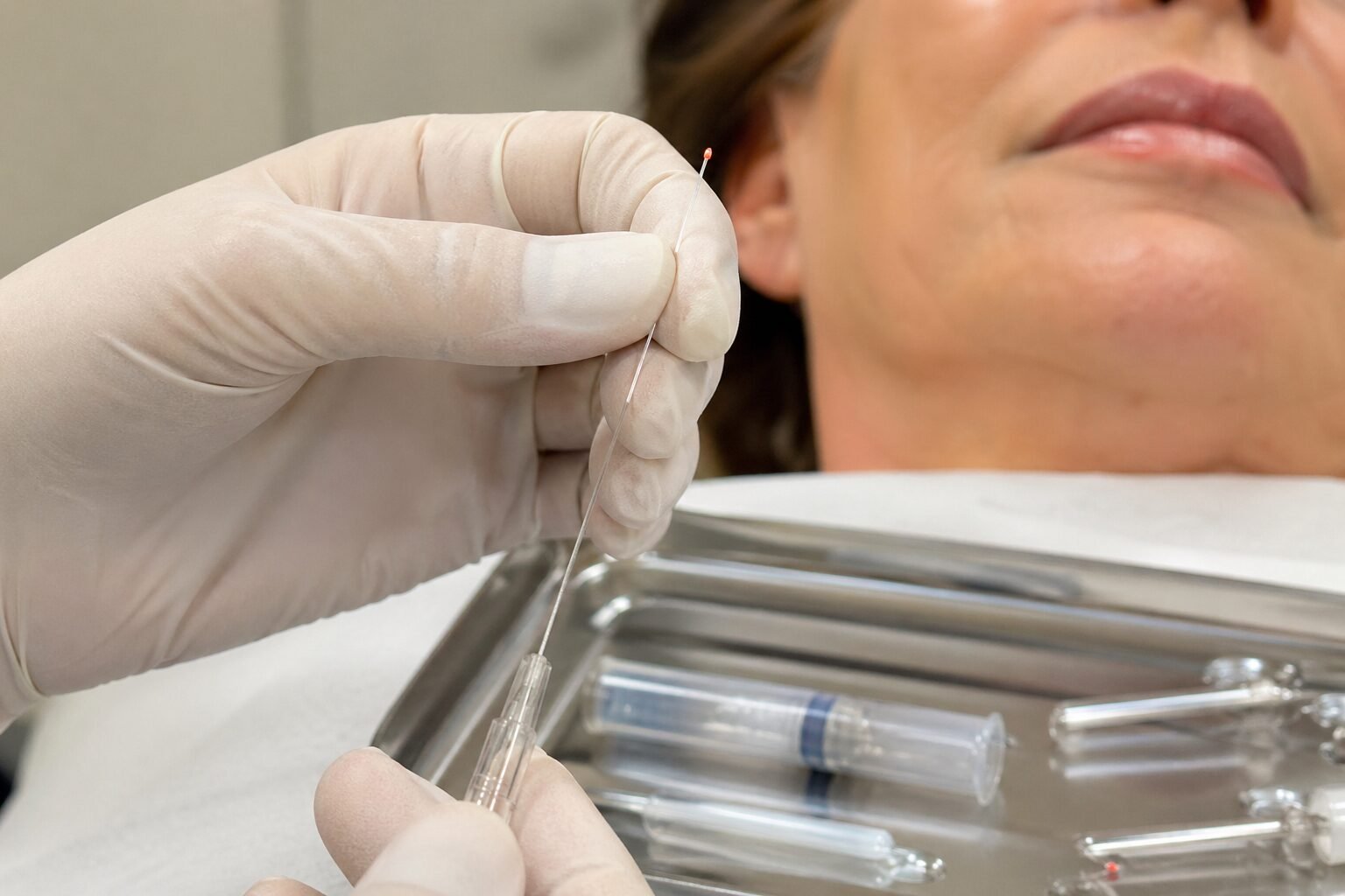 Detalle realista del proceso de endolifting con fibra láser en entorno clínico de medicina estética en Girona