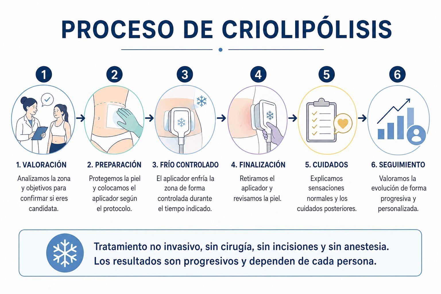 Proceso de criolipólisis paso a paso Esquema sencillo del proceso de criolipólisis con valoración, frío controlado y seguimiento posterior