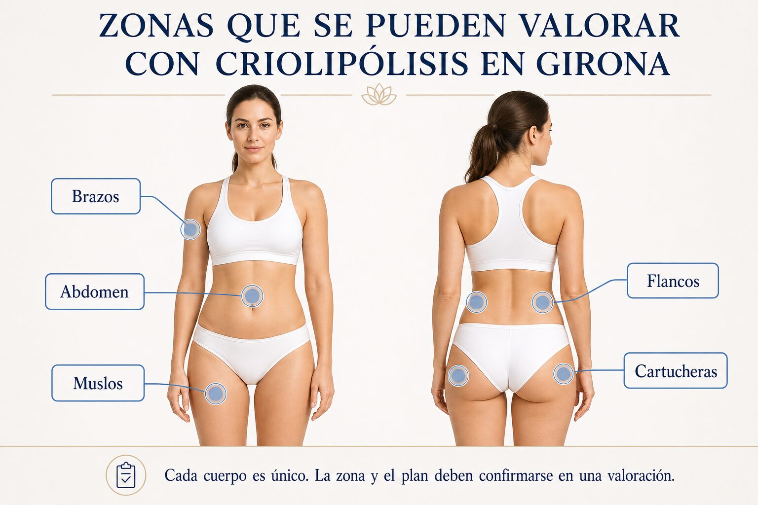 Zonas que se pueden valorar con criolipólisis Zonas corporales que se pueden valorar para criolipólisis en Girona: abdomen, flancos, muslos y brazos