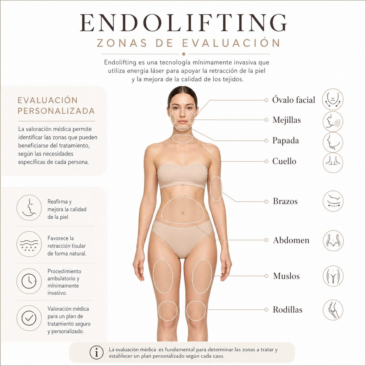 Infografía de zonas de endolifting en rostro, cuello, papada y cuerpo para pacientes de Girona y Costa Brava