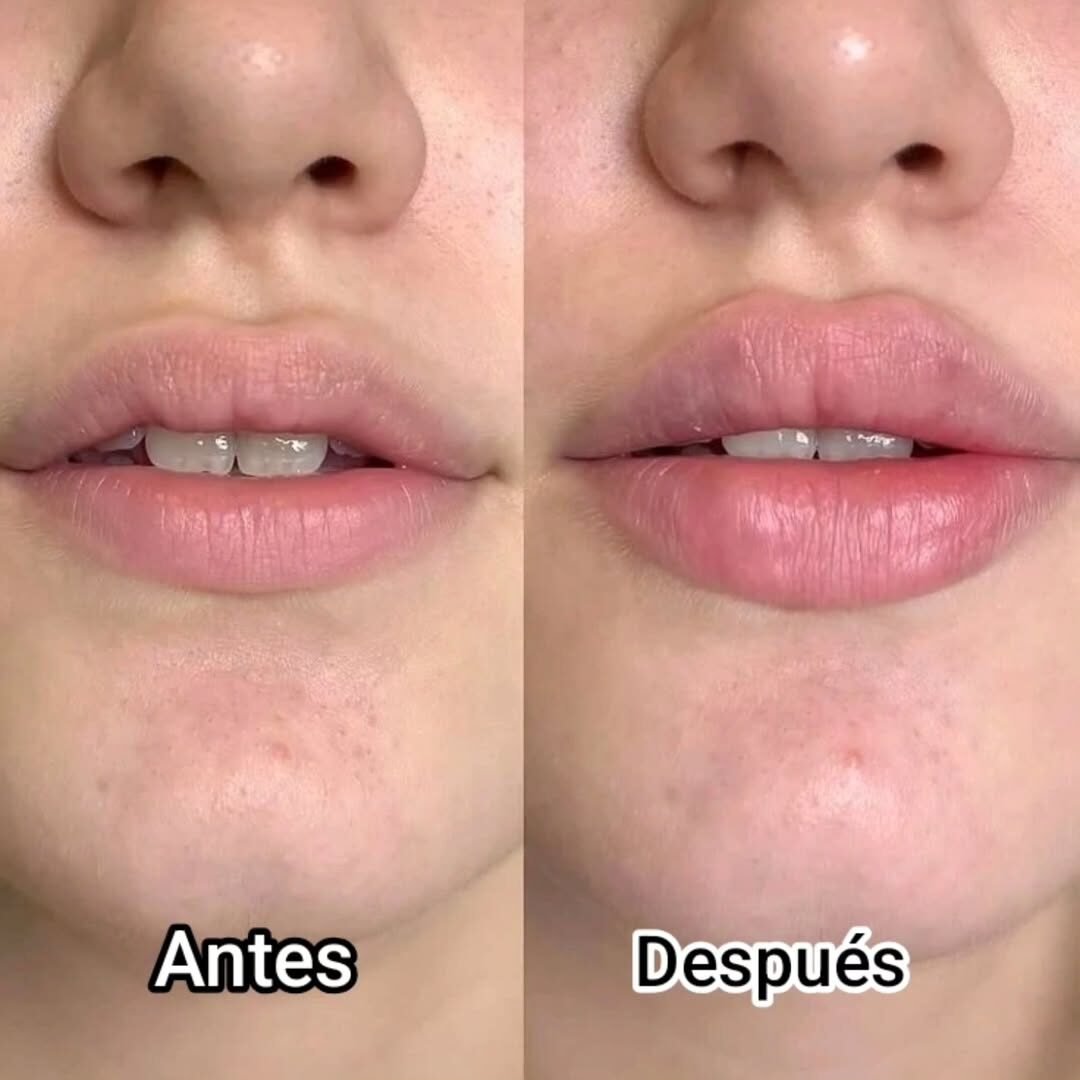 Aumento sutil + definición de contorno